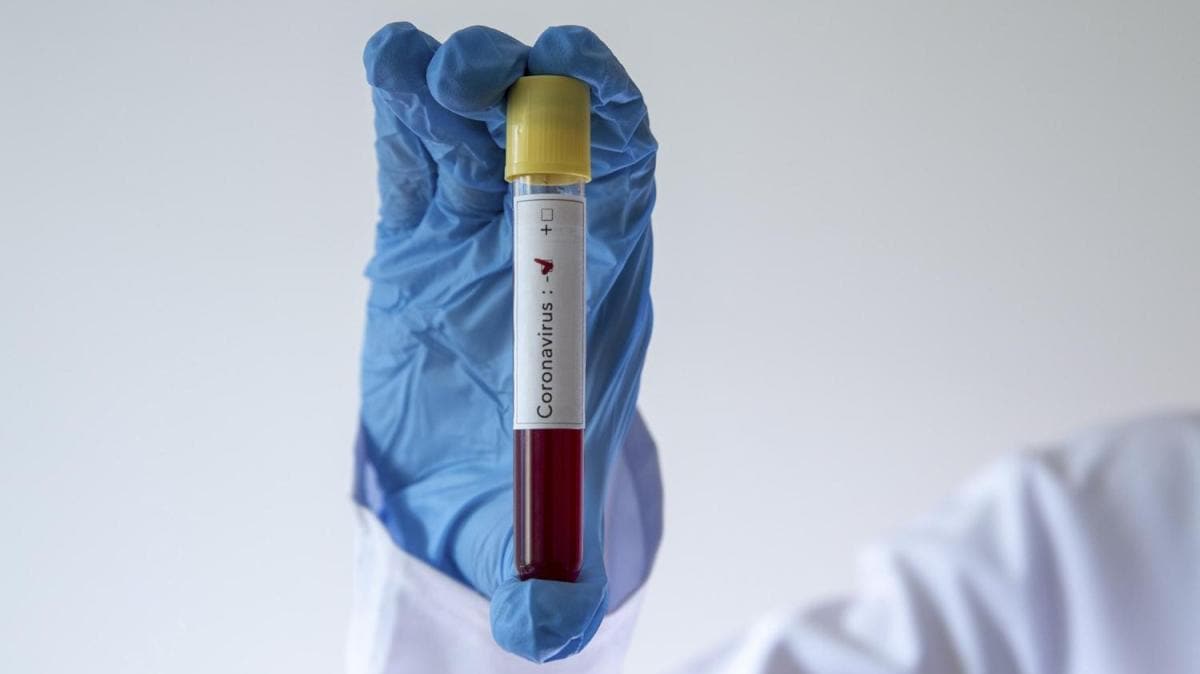 ran'da koronavirs nedeniyle 140 kii daha hayatn kaybetti