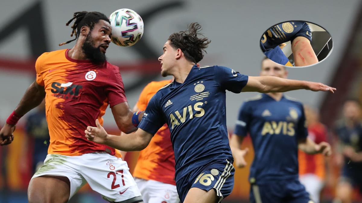 Yara i�indeki kolunu payla�t�