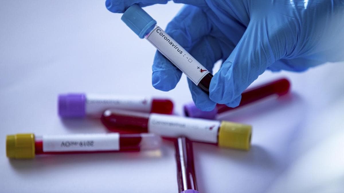 Dnyada tespit edilen toplam koronavirs vaka says 34 milyon 166 bini geti