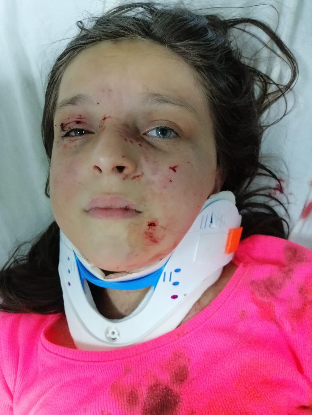 12 ya��ndaki Tu�ba'y� hastanelik eden pitbullar mahallelinin korkulu r�yas�