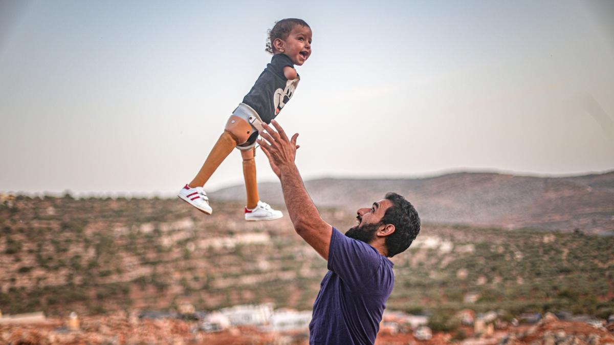 Trkiye'de protez bacaklarna kavuan Muhammed bebein yz artk glyor