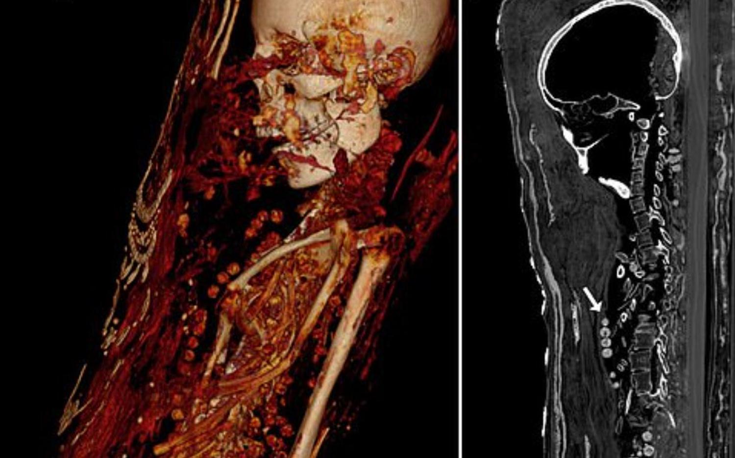 400 y�ll�k s�rlar� teknoloji ile a���a ��kt�