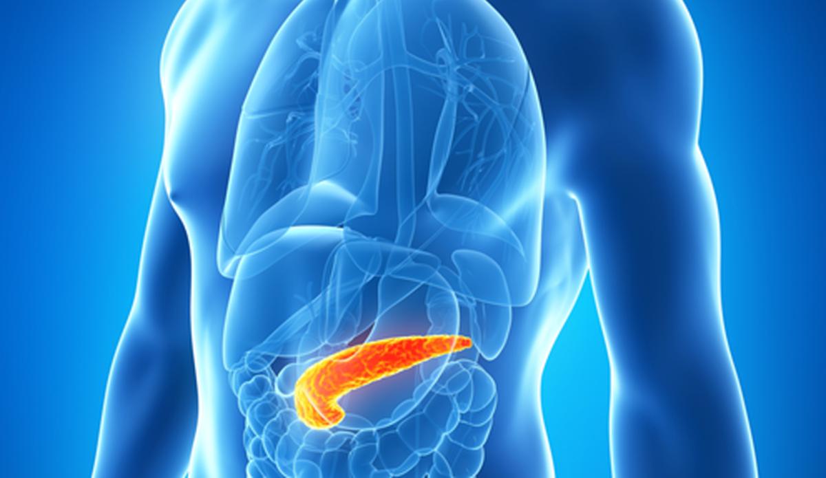 Uzmanndan nemli uyar: Pankreas kanserinin grlme skl artyor