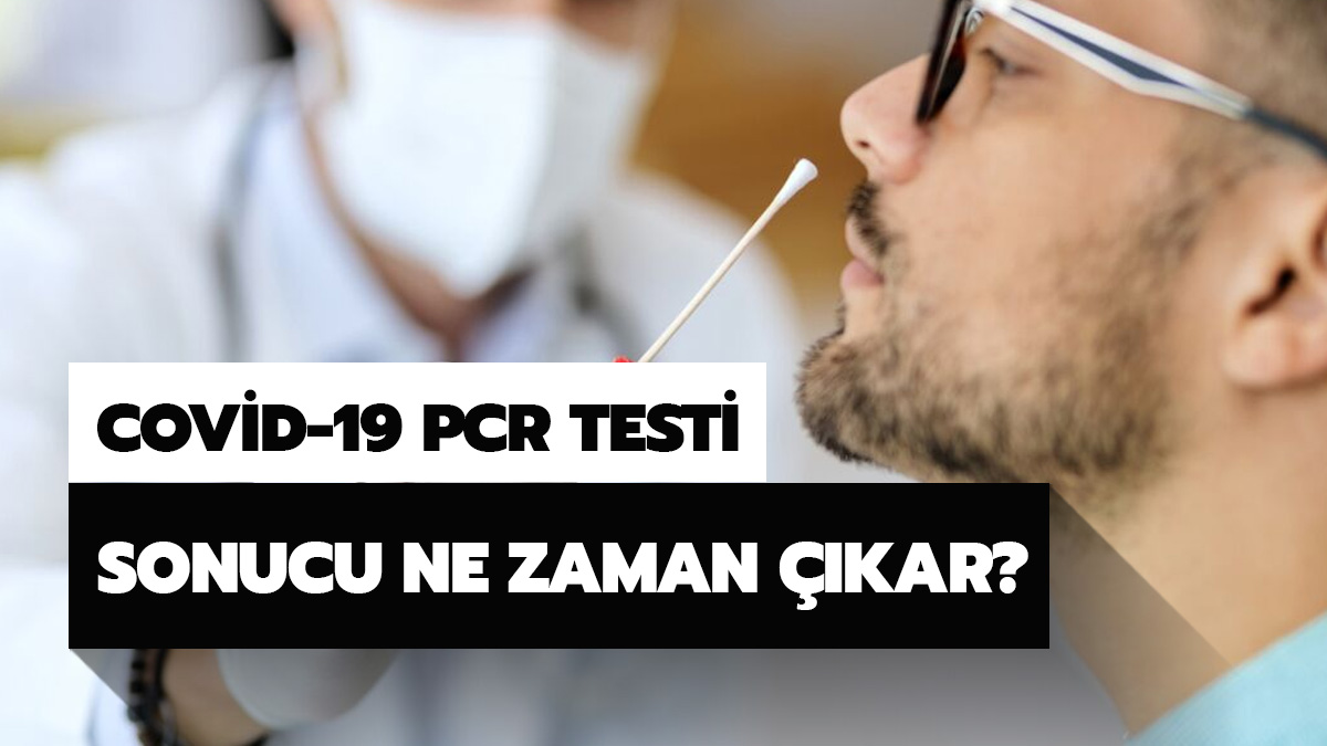 PCR testi ne kadar s�rede ��k�yor?