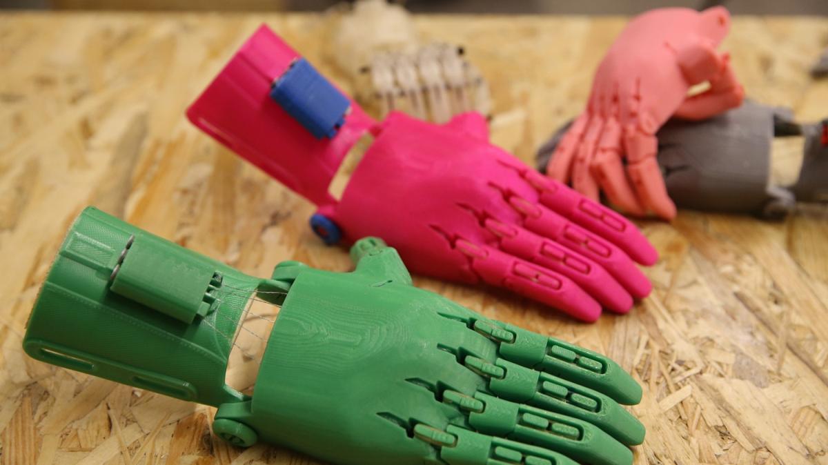 Tasarlad protezlerle ocuklara 'yardm eli' uzatyor