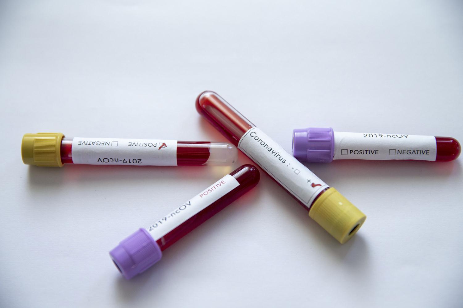 Rusya'da 86 milyon koronavir�s testi yap�ld�