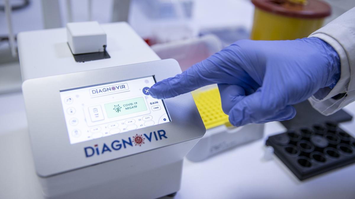 Trk bilim insanlar, koronavirs tehisini 10 saniyeye dren, PCR'n yerini almaya aday tan sistemi gelitirdi