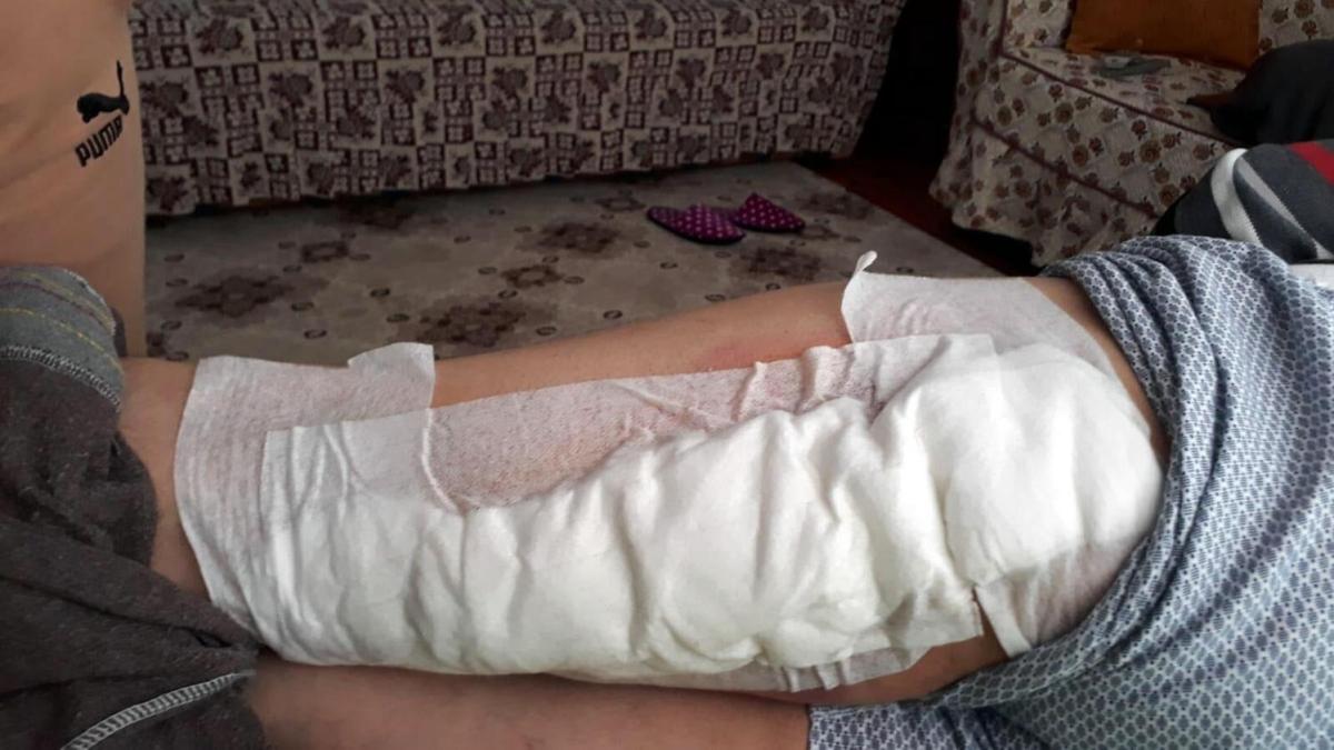 Aydn'da domuzun saldrd iftinin bacana 60 diki atld 