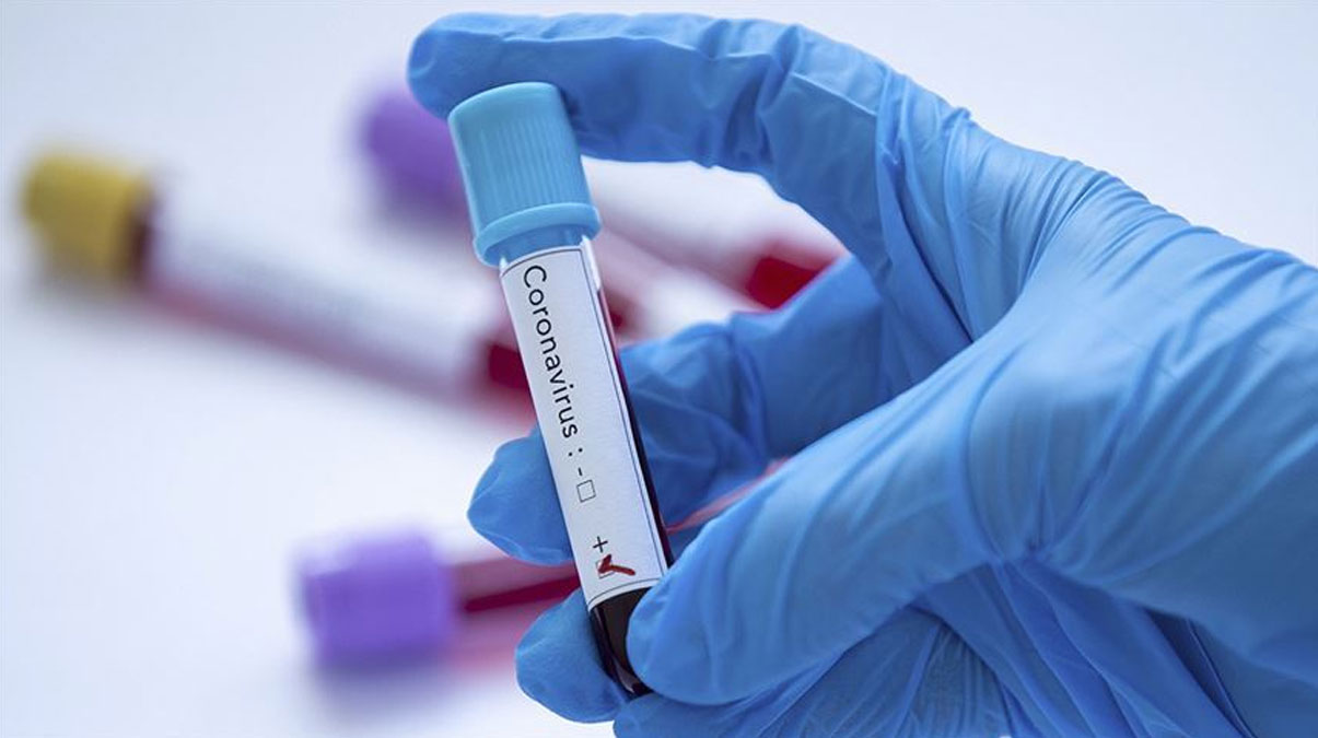 T�rkiye'nin koronavir�sle m�cadelesi