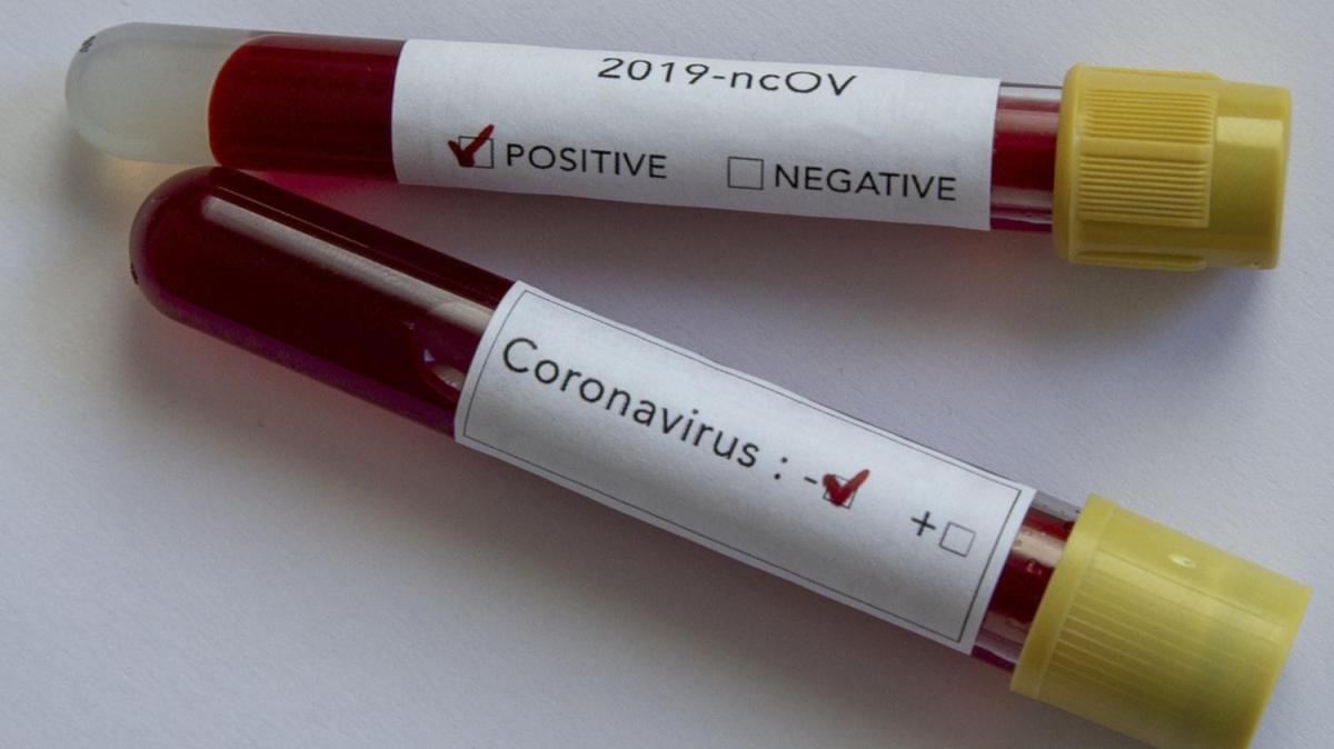 ABD'de koronavirs nedeniyle hayatn kaybedenlerin says 431 bini at