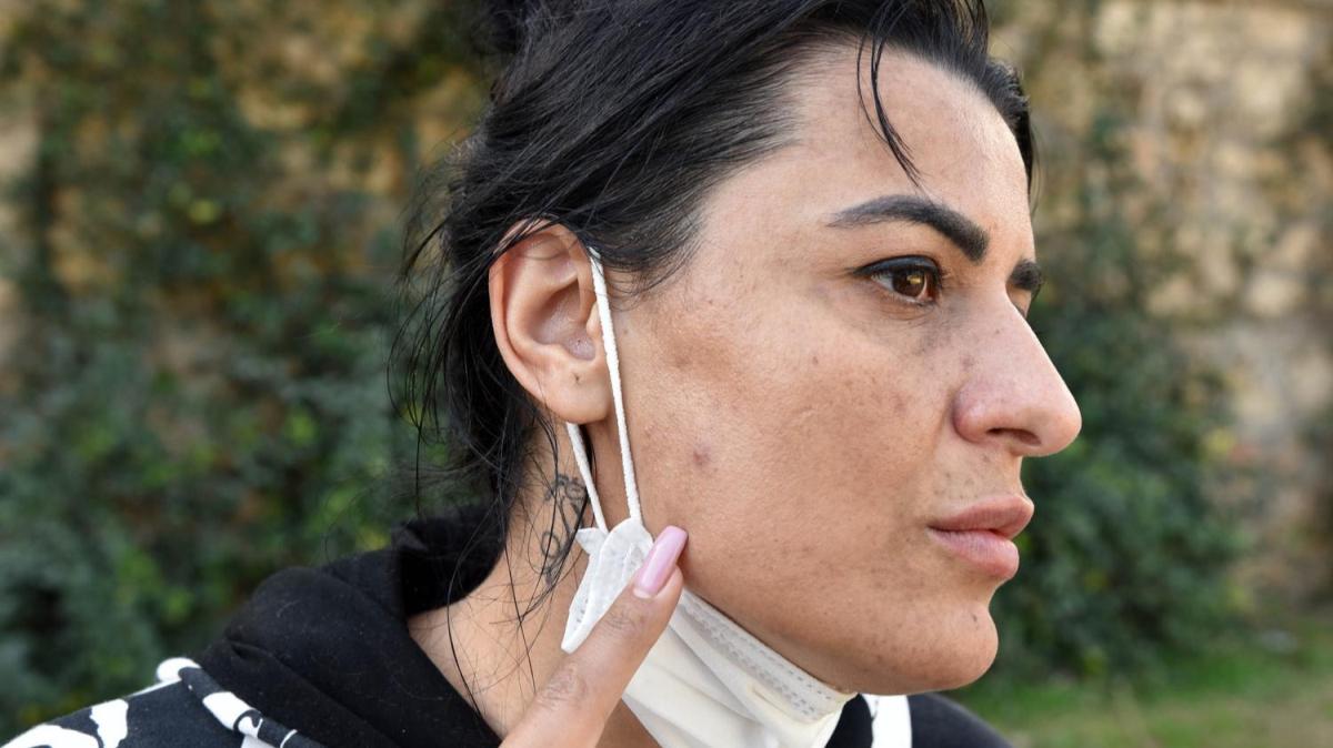 Gzellemek iin gittii merkezde yzn yaktlar