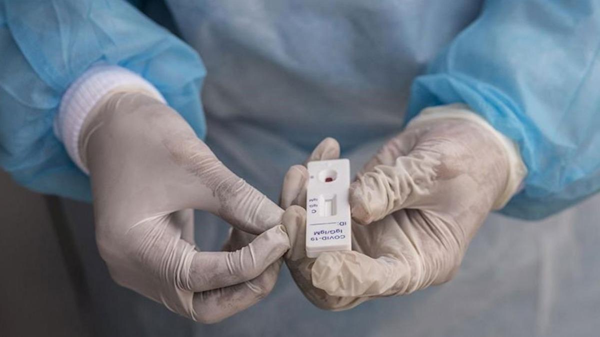 Trkiye'de son 24 saatte 7.241 koronavirs vakas tespit edildi, 83 kii hayatn kaybetti