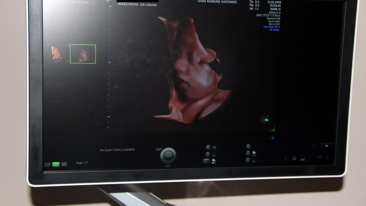 Gebelikte detayl ultrason hayati nem tayor