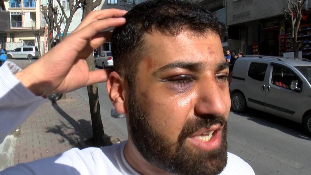 ''Polis bama vurdu'' demiti... Yalan ortaya kt 