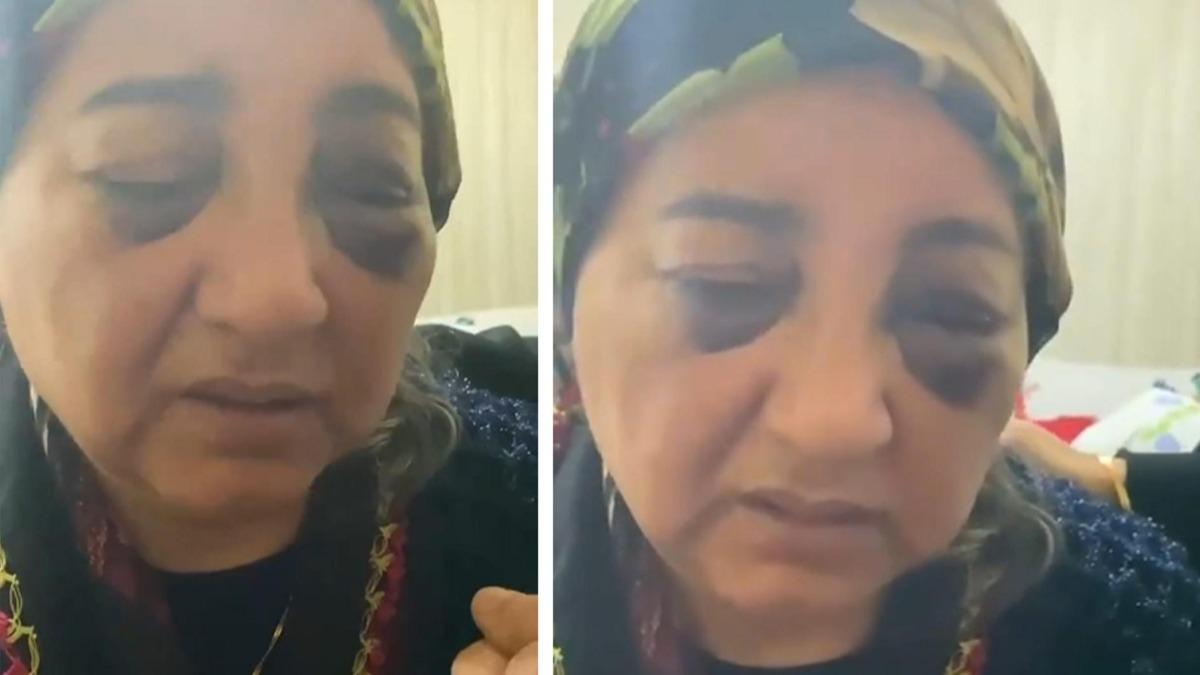 Eini 2 gn boyunca a susuz braklp iddet uygulanan koca yakaland