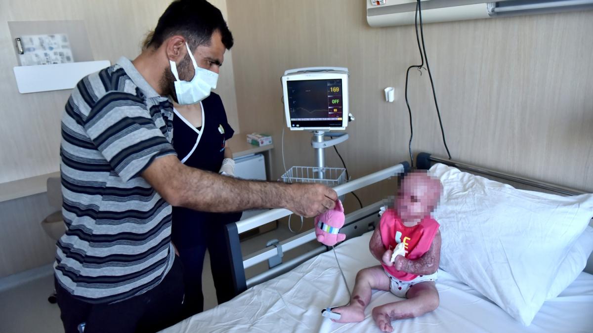 dlib'de adr kent yangnnda yaralanan 21 aylk bebek Trkiye'de yaam savan kazand