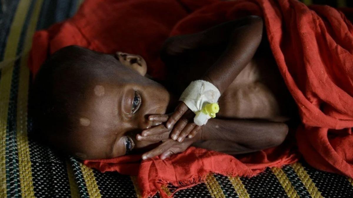 Kenya'da kuraklk: 200 bin kii gnde bir n yemek tketebiliyor
