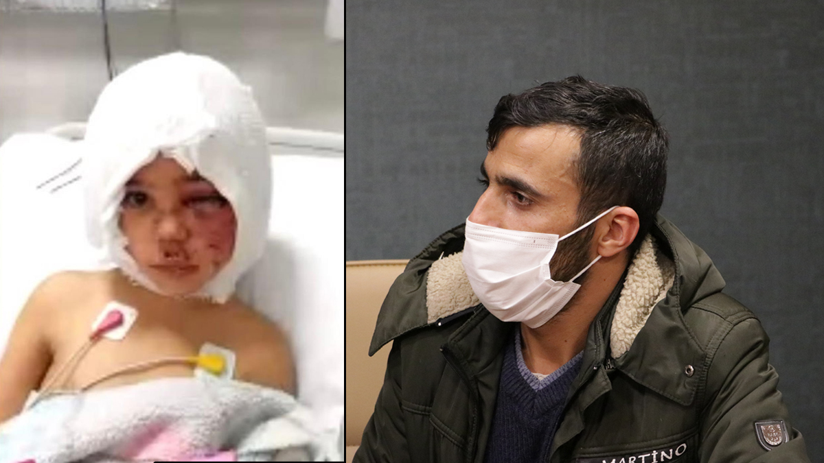 Pitbull'un sald�r�s�na u�rayan �ocu�un  babas� ya�ad�klar�n� anlatt�