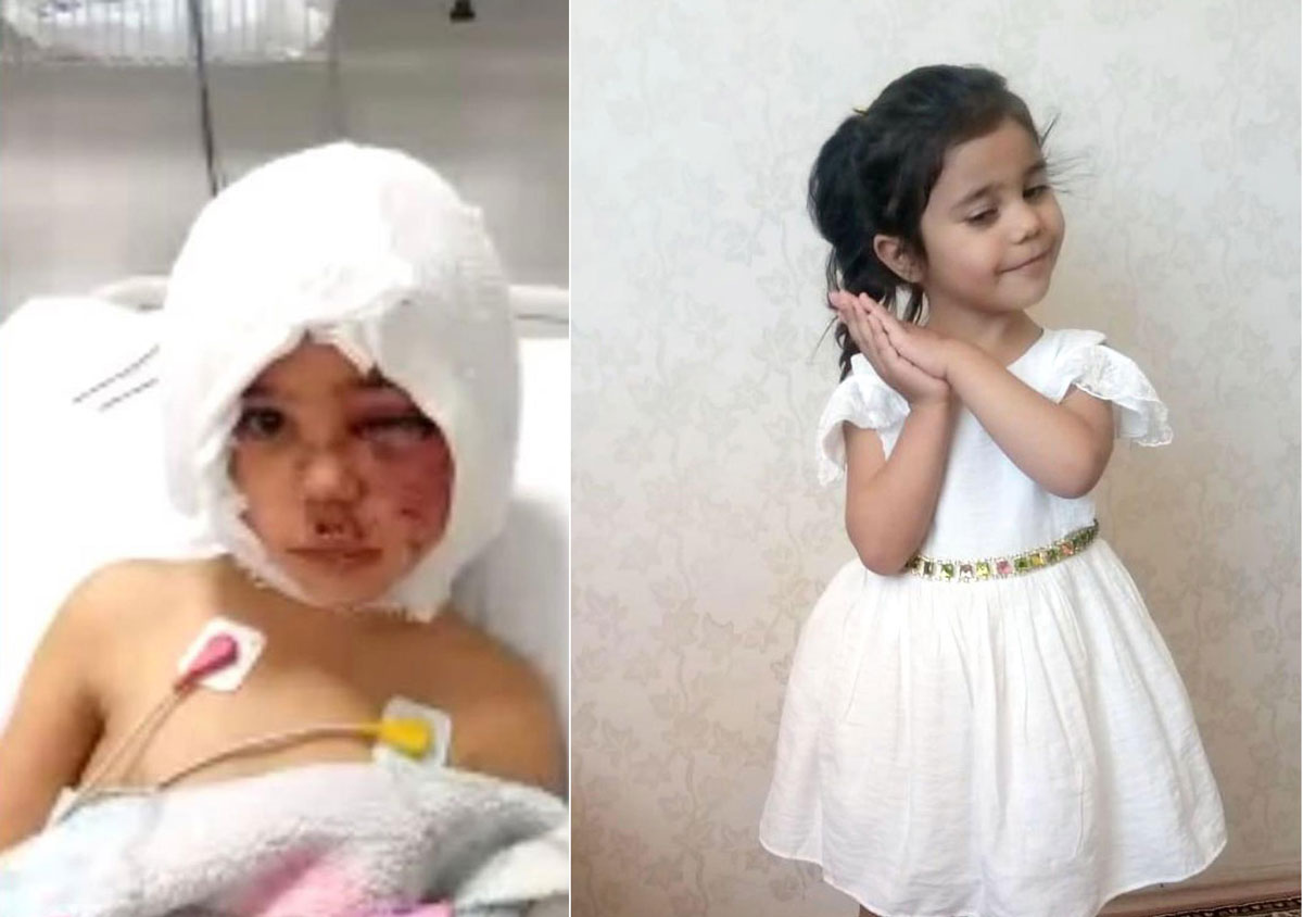 Pitbull sald�r�s�nda yaralanan Asiye'yle ilgili �nemli geli�me!