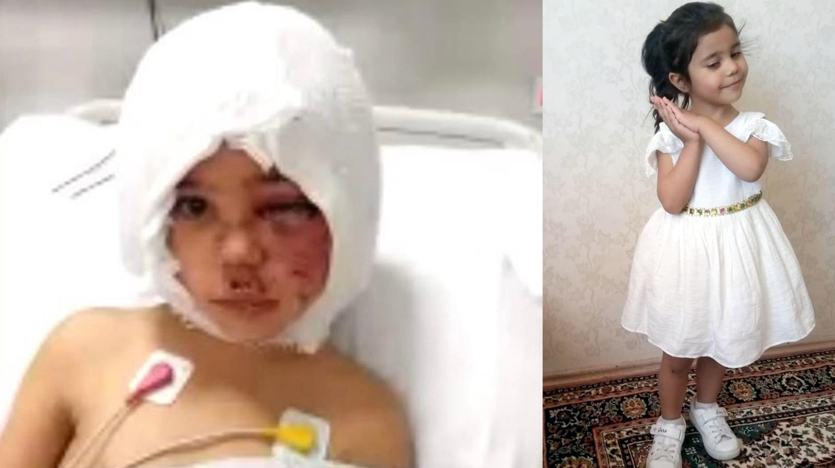 Pitbull sald�r�s�na u�rayan Asiye'den g�zel haber