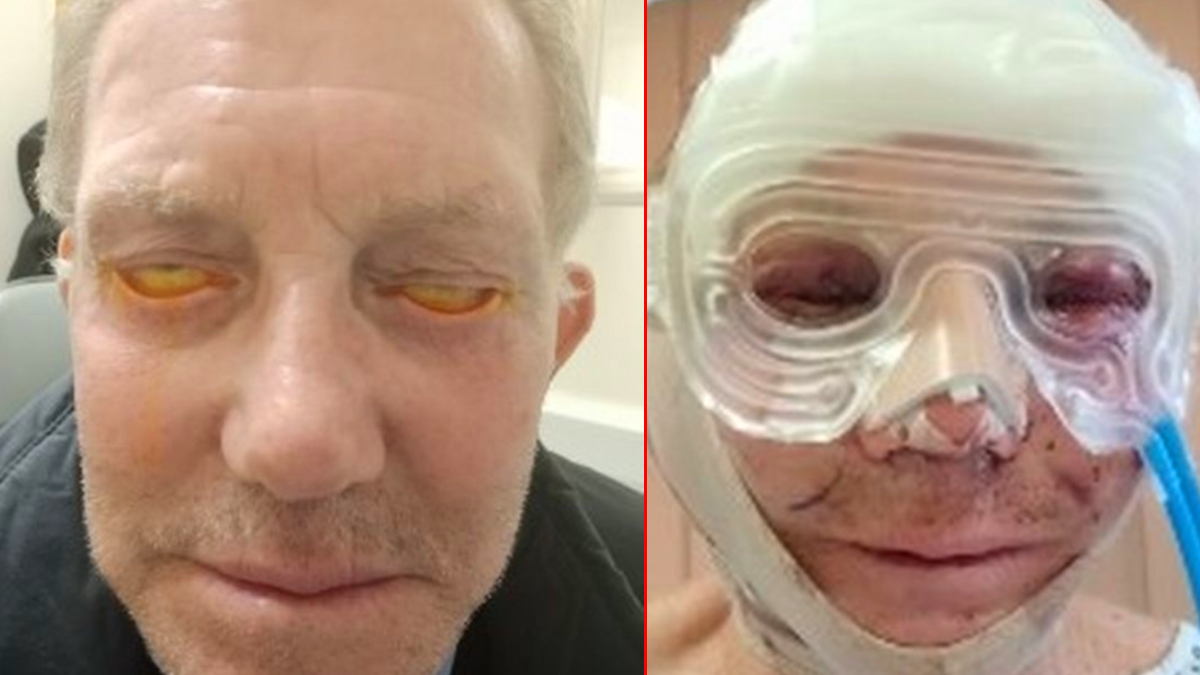 �� y�ld�r g�zlerini kapatam�yor! �areyi T�rkiye'de buldu