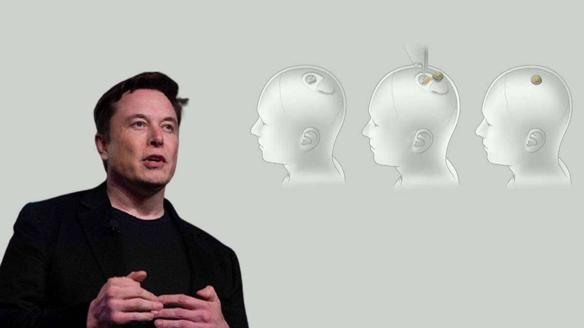 Elon Musk'n beyin ipi plan kritik dneme! e almlar sinyal verdi