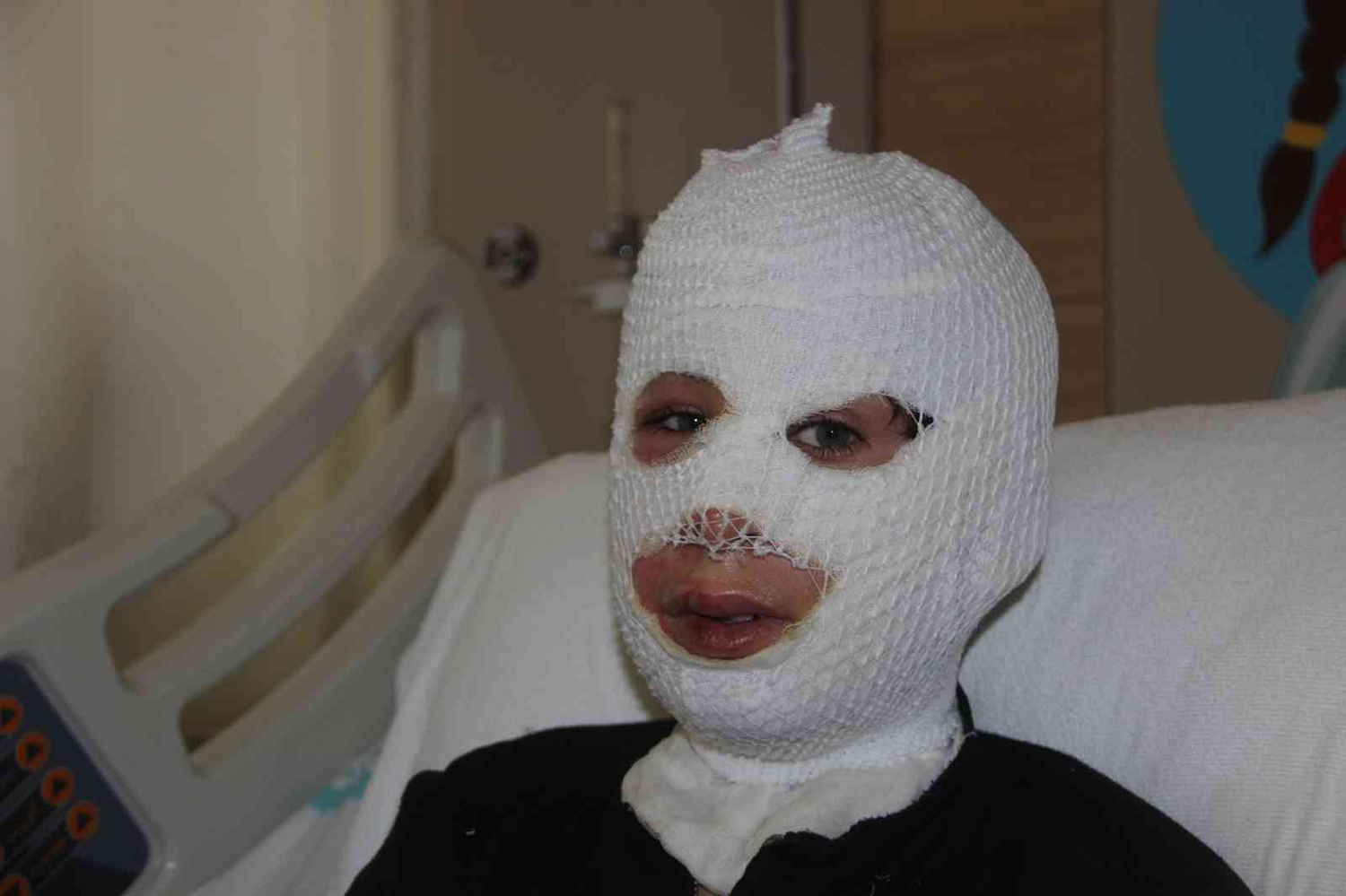 Soban�n �zerindeki �aydanl���n devrilmesi sonucu 13 ya��ndaki �ocuk yand�