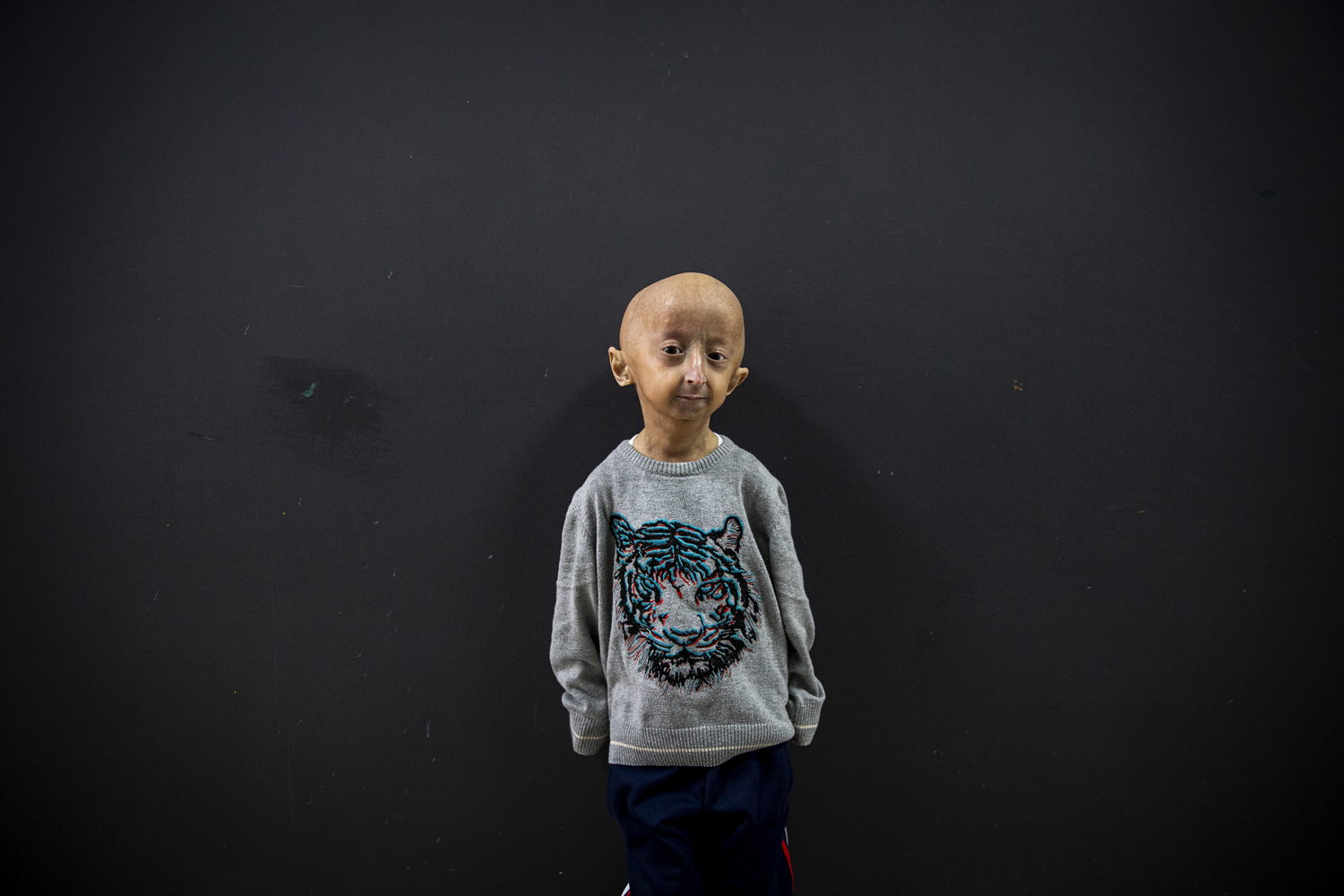 8 milyon ki�ide 1 g�r�l�yor! Tek hayali ya��tlar� gibi olabilmek