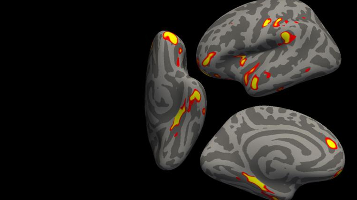 T�r�n�n en b�y�k �rne�i! Covid-19 ge�irenlerde g�r�l�yor...