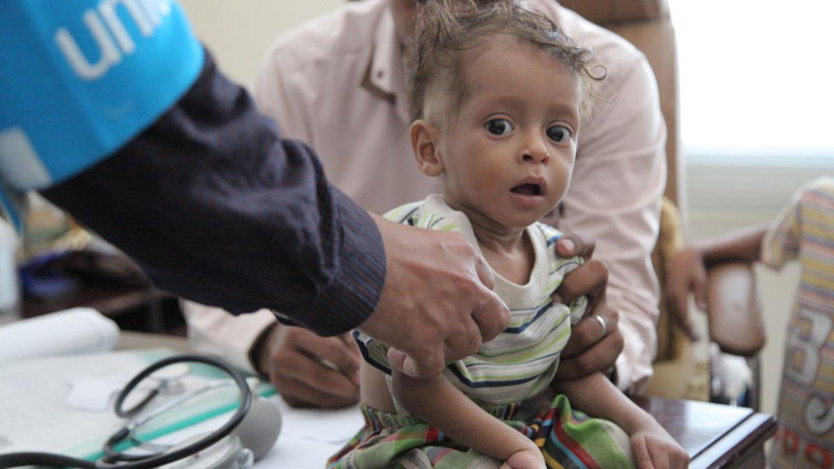 UNICEF: Milyonlarca Yemenli ala srkleniyor