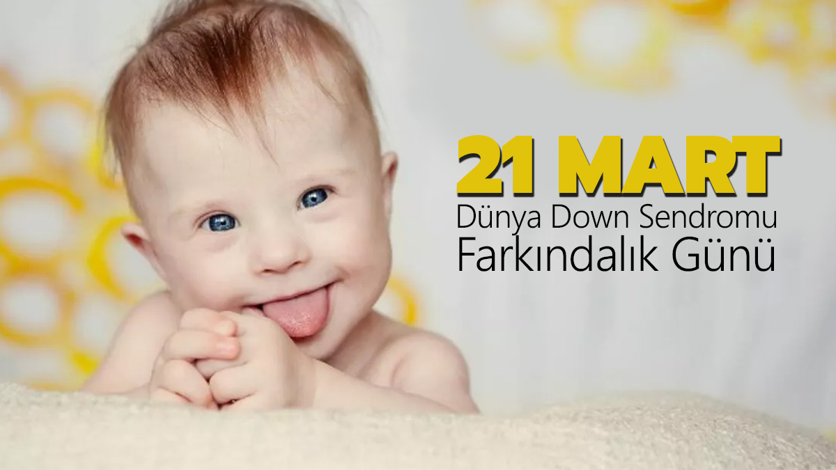 Down sendromlular g�n� mesajlar�!