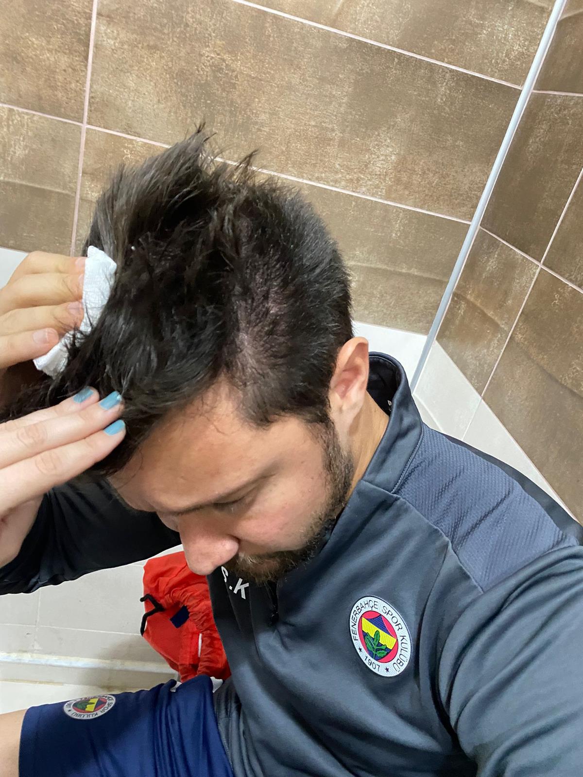 Amedspor - Fenerbah�e ma��nda ortal�k kar��t�!