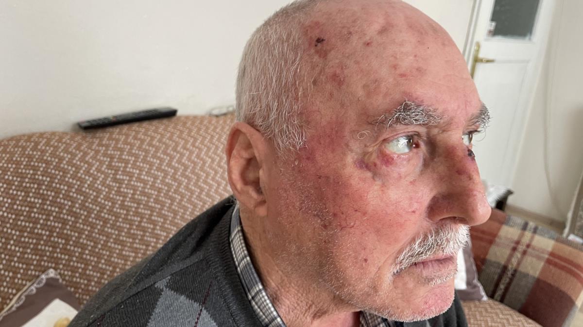 Aklalmaz olay! ETT ofr, tartt 75 yandaki adam darp etti