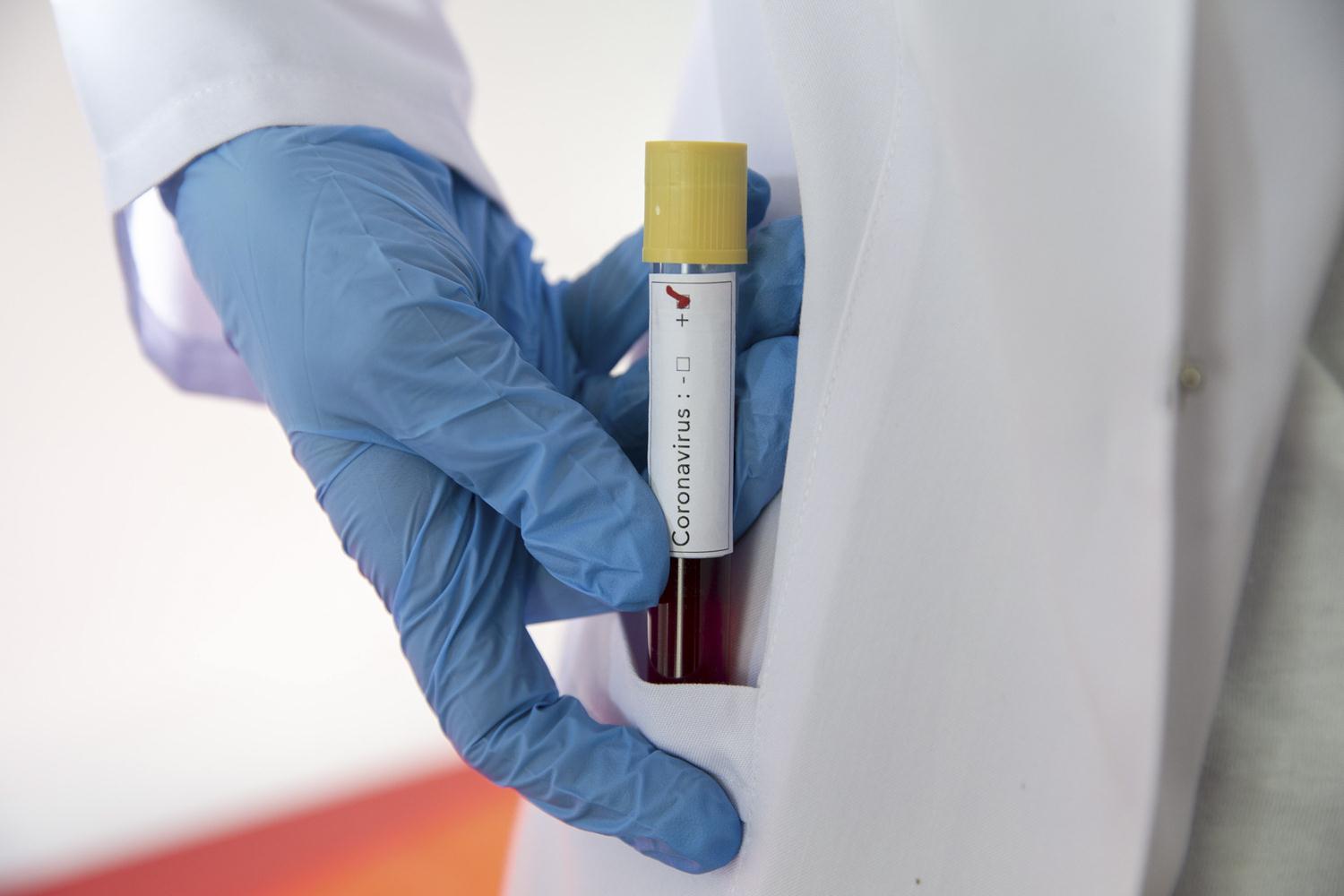 Koronavir�s Bilim Kurulu �yesi Prof. Dr. Turan: Vaka say�lar�n�n haziranda 1000'in alt�na d��mesi bekleniyor