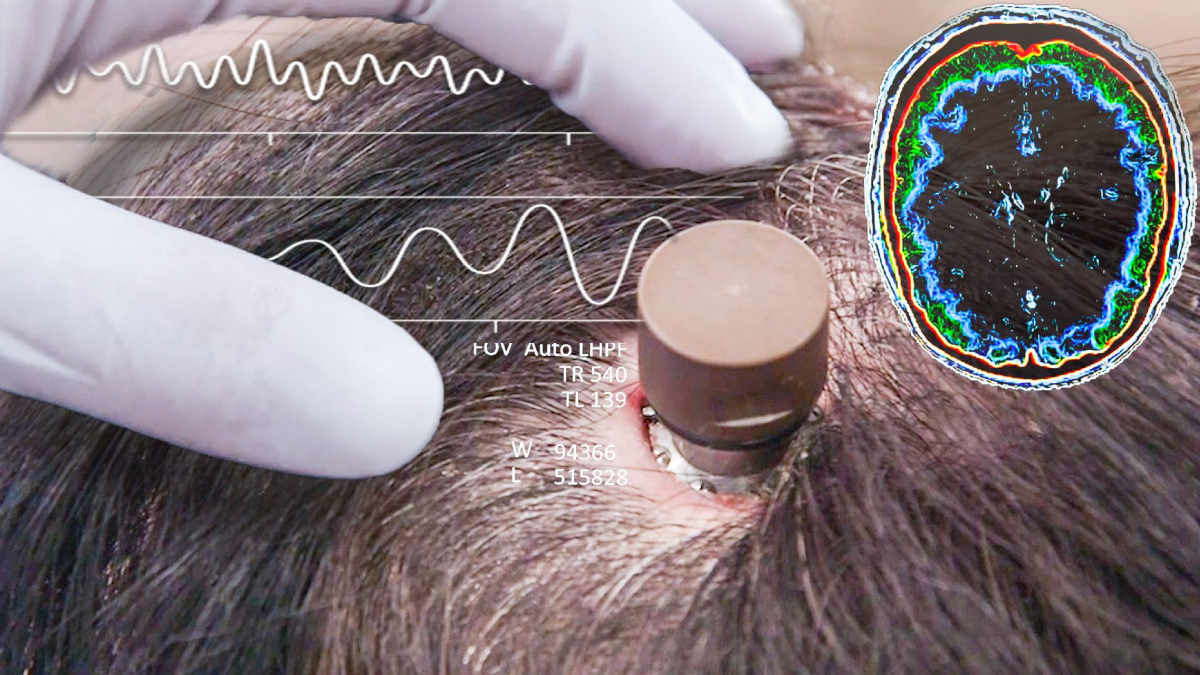 �nsan beynine �ip takma denemeleri ba�lad�