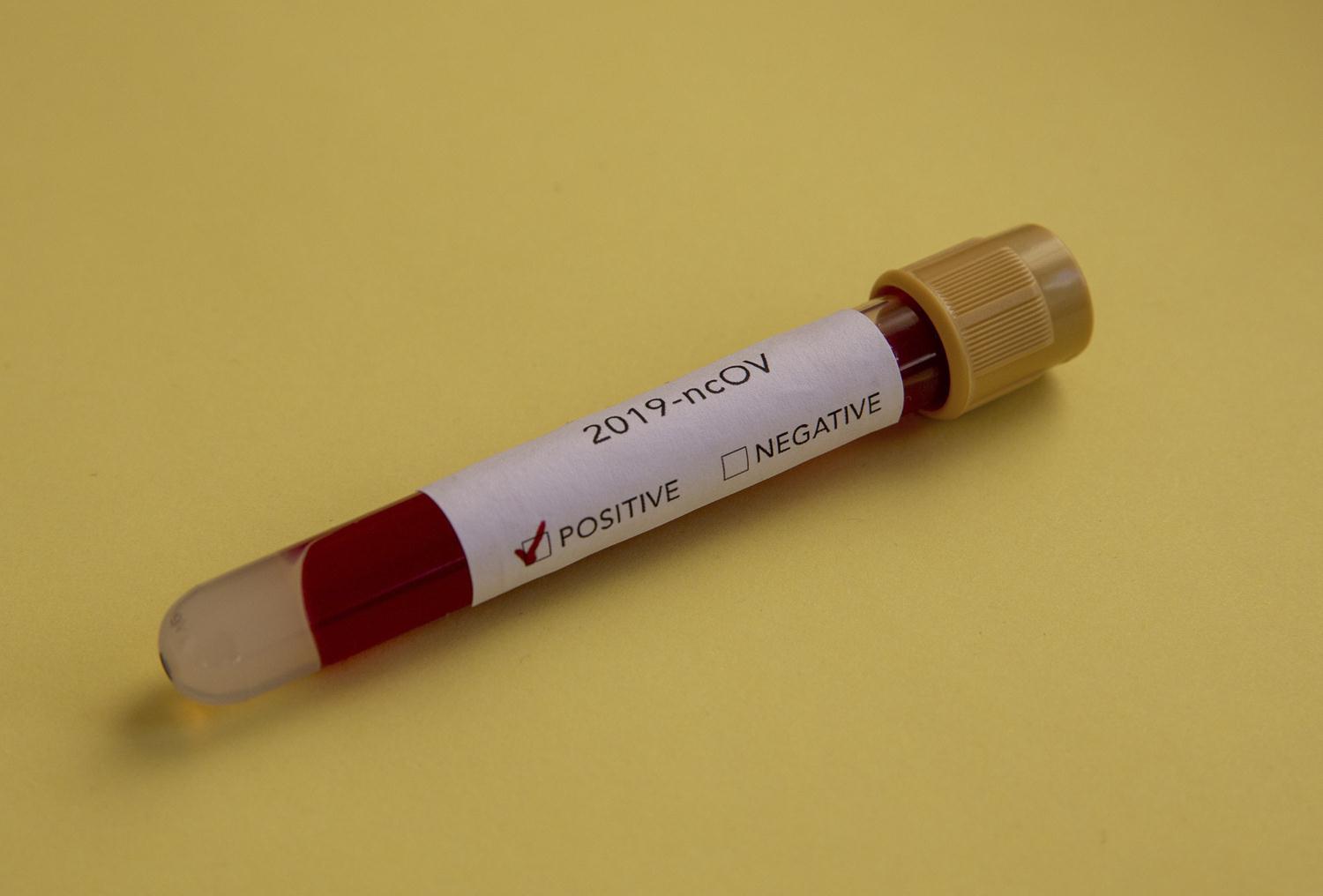 Norve� ihtiya� fazlas� 137 binden fazla Kovid-19 a��s�n�n imha edildi�i bildirdi