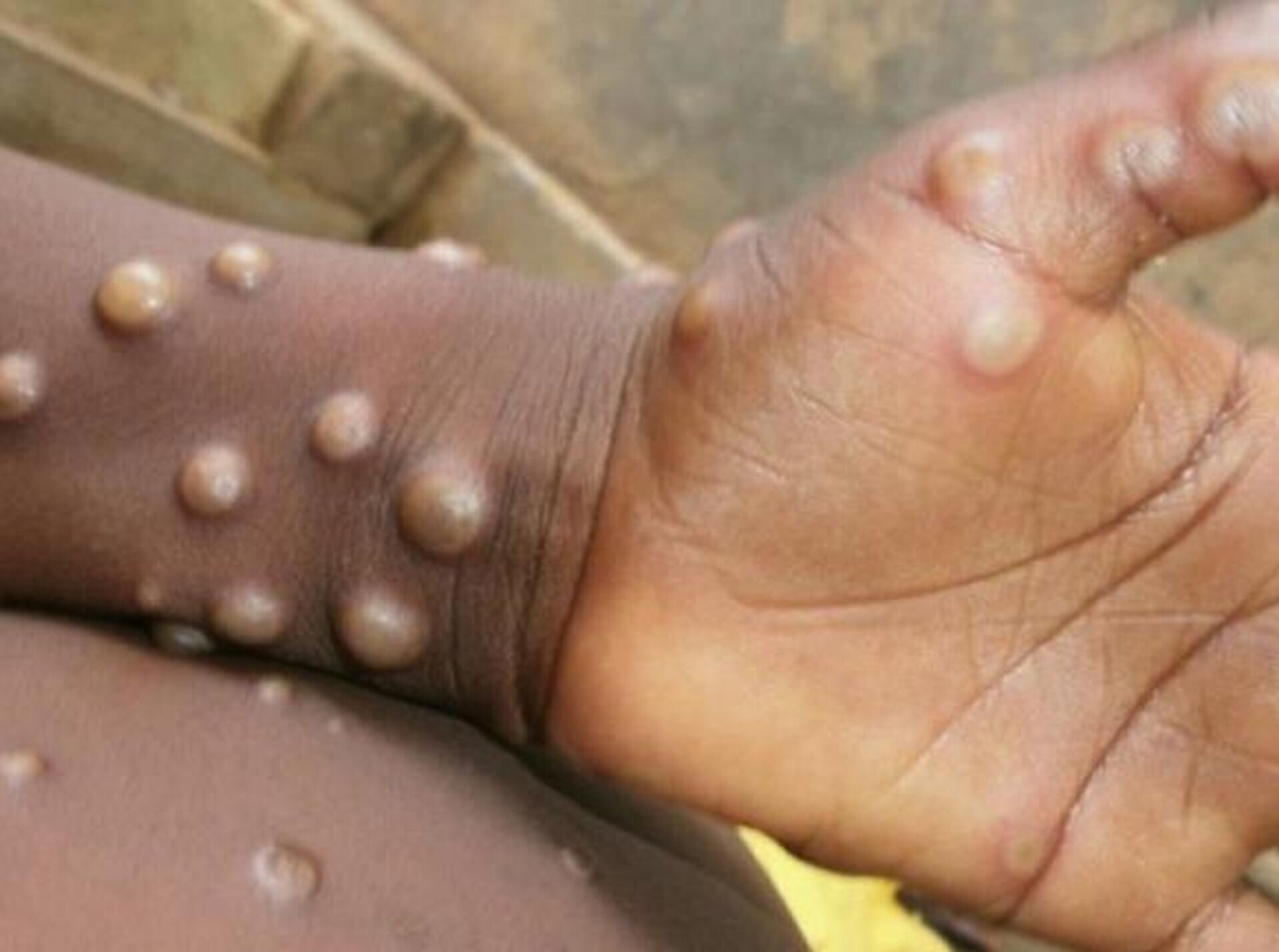 Bel�ika'dan maymun �i�e�i vir�s� i�in karantina karar�