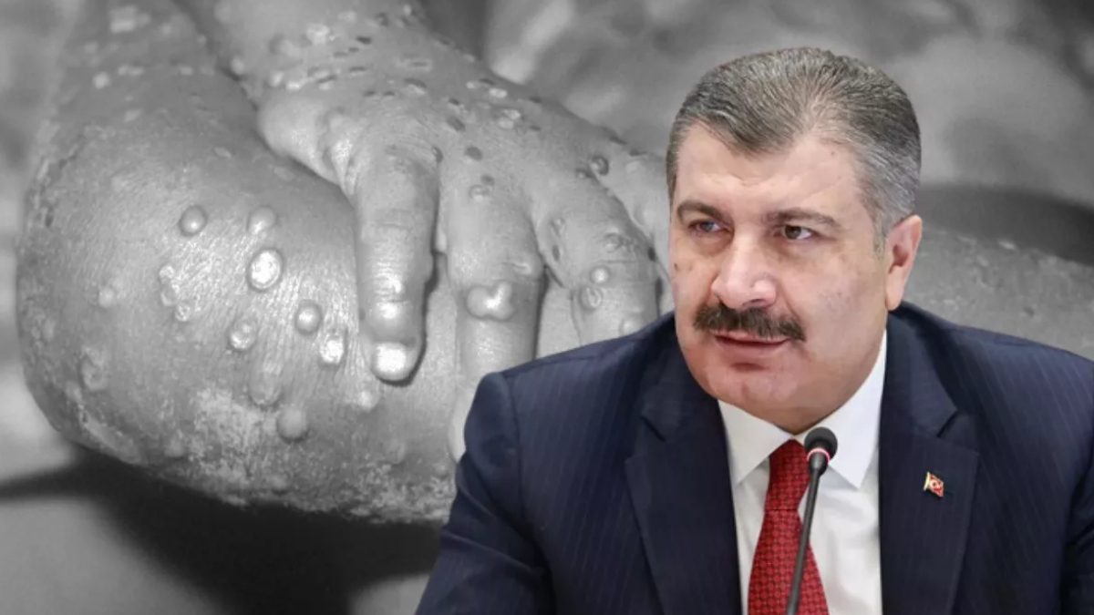 T�rkiye'de vaka var m�? Bakan Koca'dan 'maymun �i�e�i' a��klamas�
