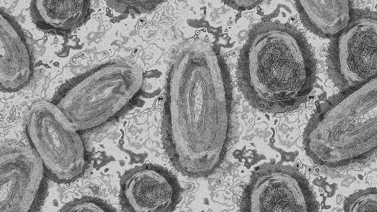 DS�'den merakla beklenen maymun �i�e�i vir�s� a��klamas�