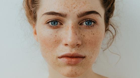 “Deri hastalıklarının çoğu güneşten kaynaklanıyor”