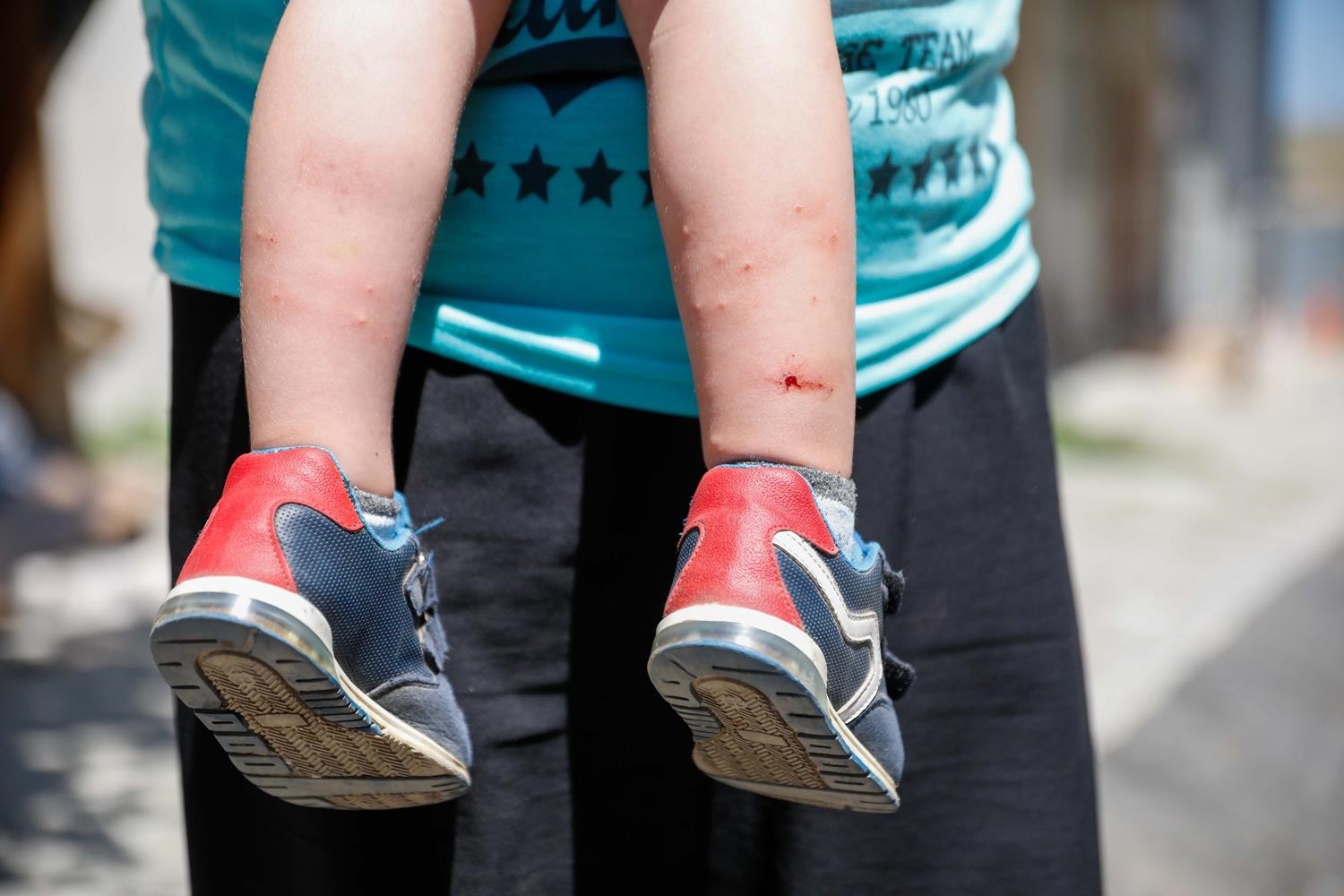 �stanbul'da 'Aedes' pani�i! �la�lama i�e yaram�yor