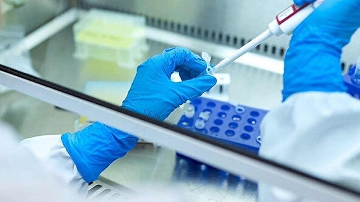 Bir saat i�inde sonu� veriyor! 'K�resel acil durum' ilan edilmi�ti: KKTC'de geli�tirildi