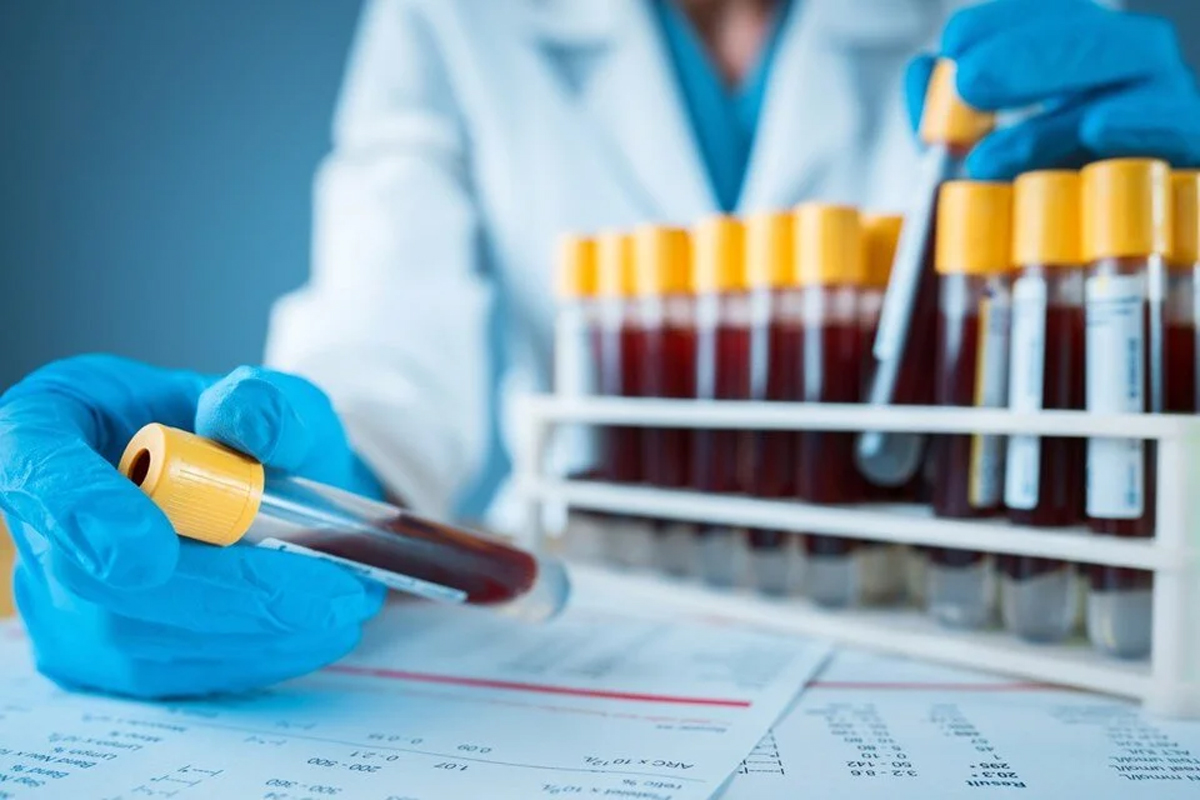 10 kanserden birini durduran kan testi
