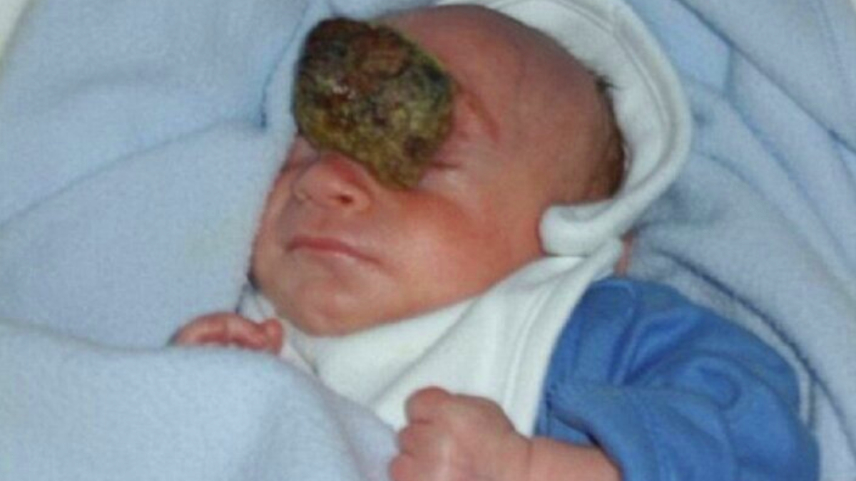 Beyni d��ar�da do�du