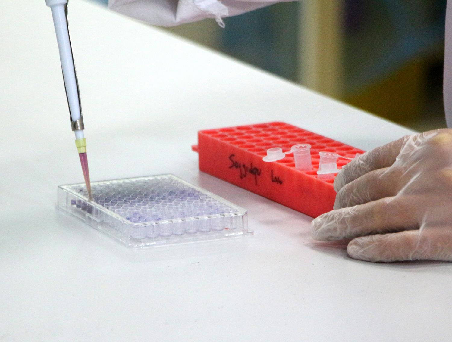 Korkutan ara�t�rma! Koronavir�s kanser h�crelerinin yay�l�m�n� h�zland�r�yor