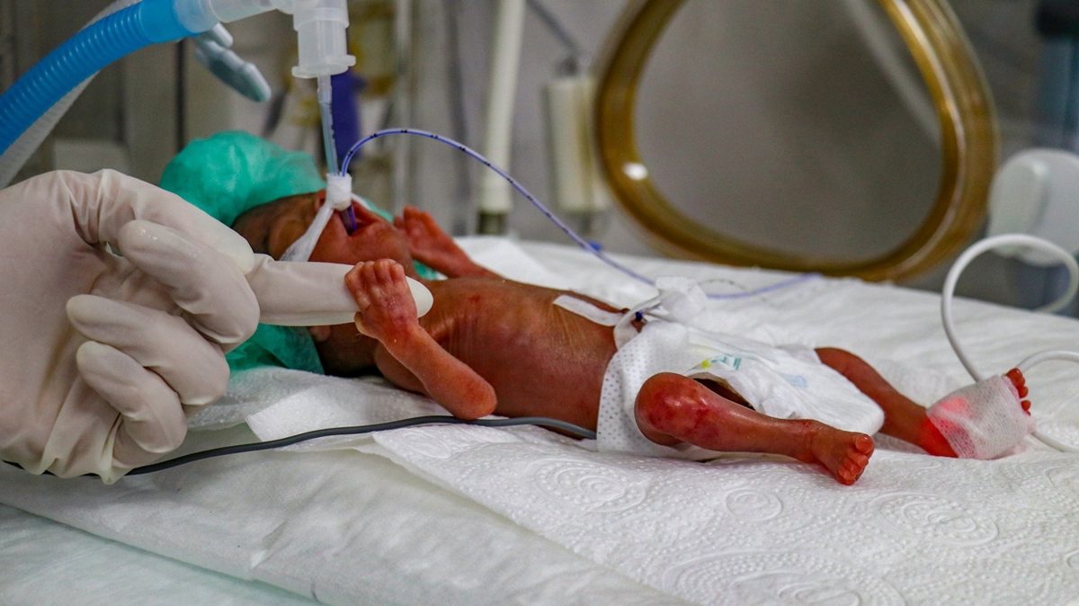 400 gram olarak dünyaya gelen bebek sağlık çalışanlarının çabasıyla hayata tutundu