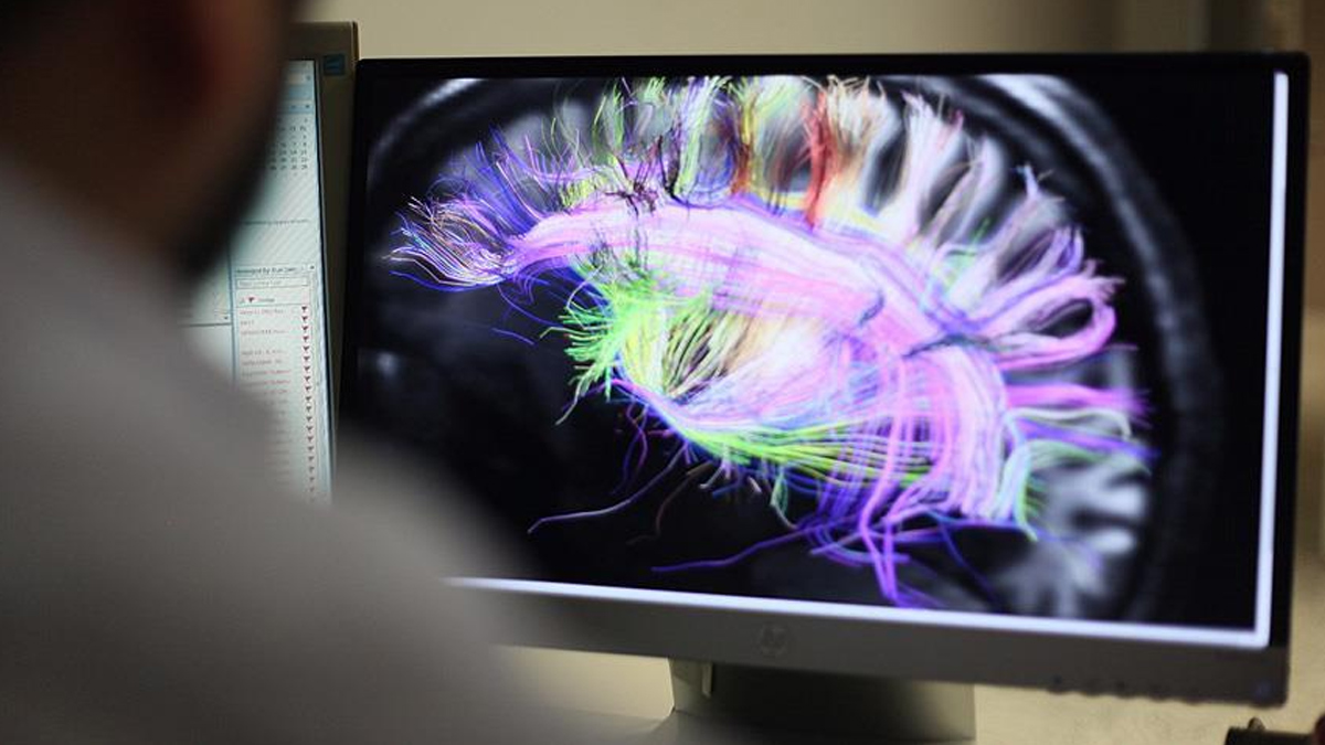 Burundan girip insan beynini yiyor! �lk �l�m ger�ekle�ti