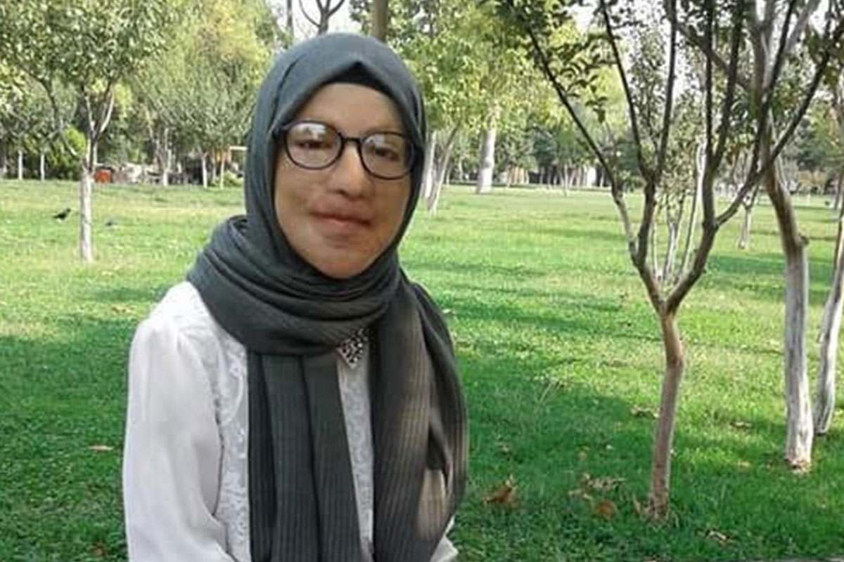 Yeni y�z�ne kavu�mak i�in 47 kez ameliyat oldu