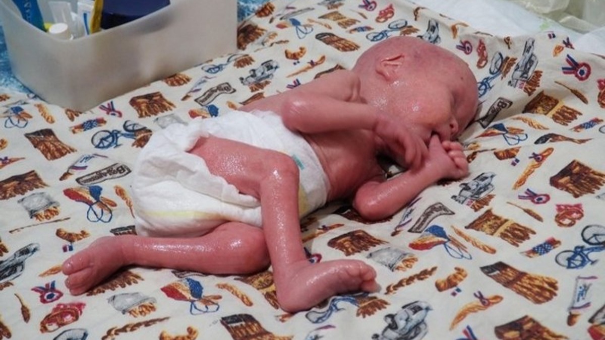Ylan bebek davasnda yeni gelime!