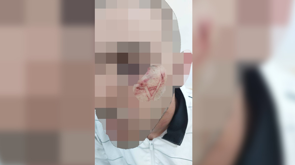 srail Hitler'in izinde! Filistinli gencin yzn ''Davud Yldz'' izerek kazdlar
